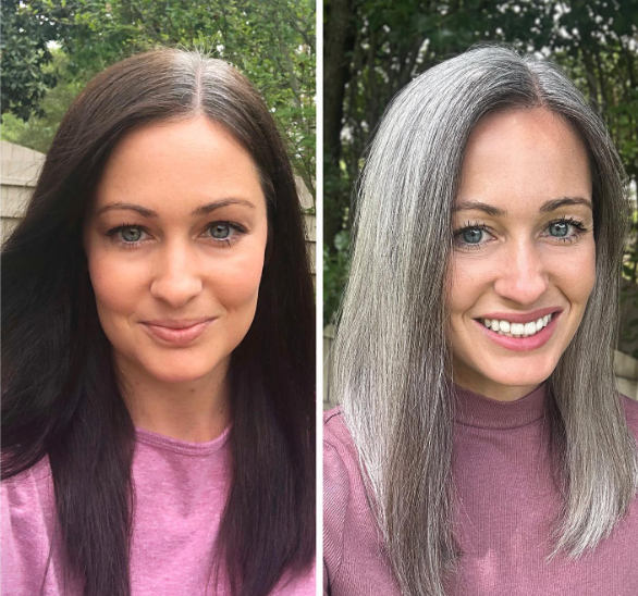Thick Gray Hair Before After
